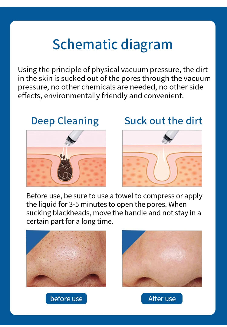 CASMB 7-in-1 Hydro Facial Machine – Professionelle Gesichtspflege mit Ultraschall, Sauerstoff & Dermabrasion für Tiefenreinigung und Hautverjüngung