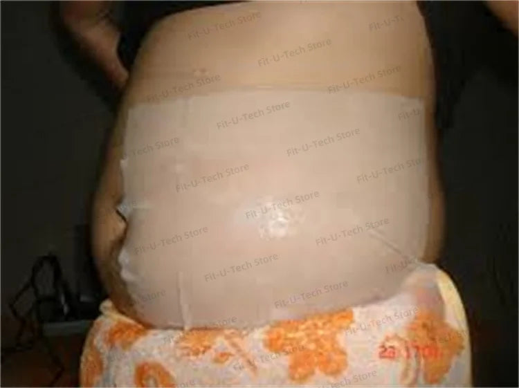 Kryolipolyse Schutzmembran – 60 + 70 g Thick Freezing Mask